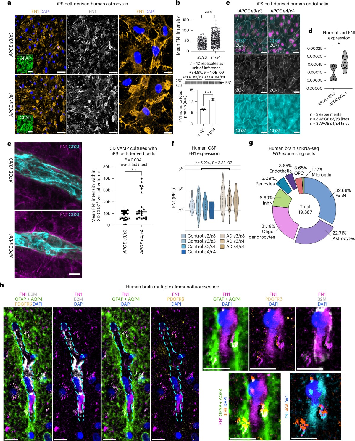 La brecha en la aduana cerebral: cómo el gen APOE4 y la fibronectina abren la puerta al Alzheimer décadas antes de los síntomas