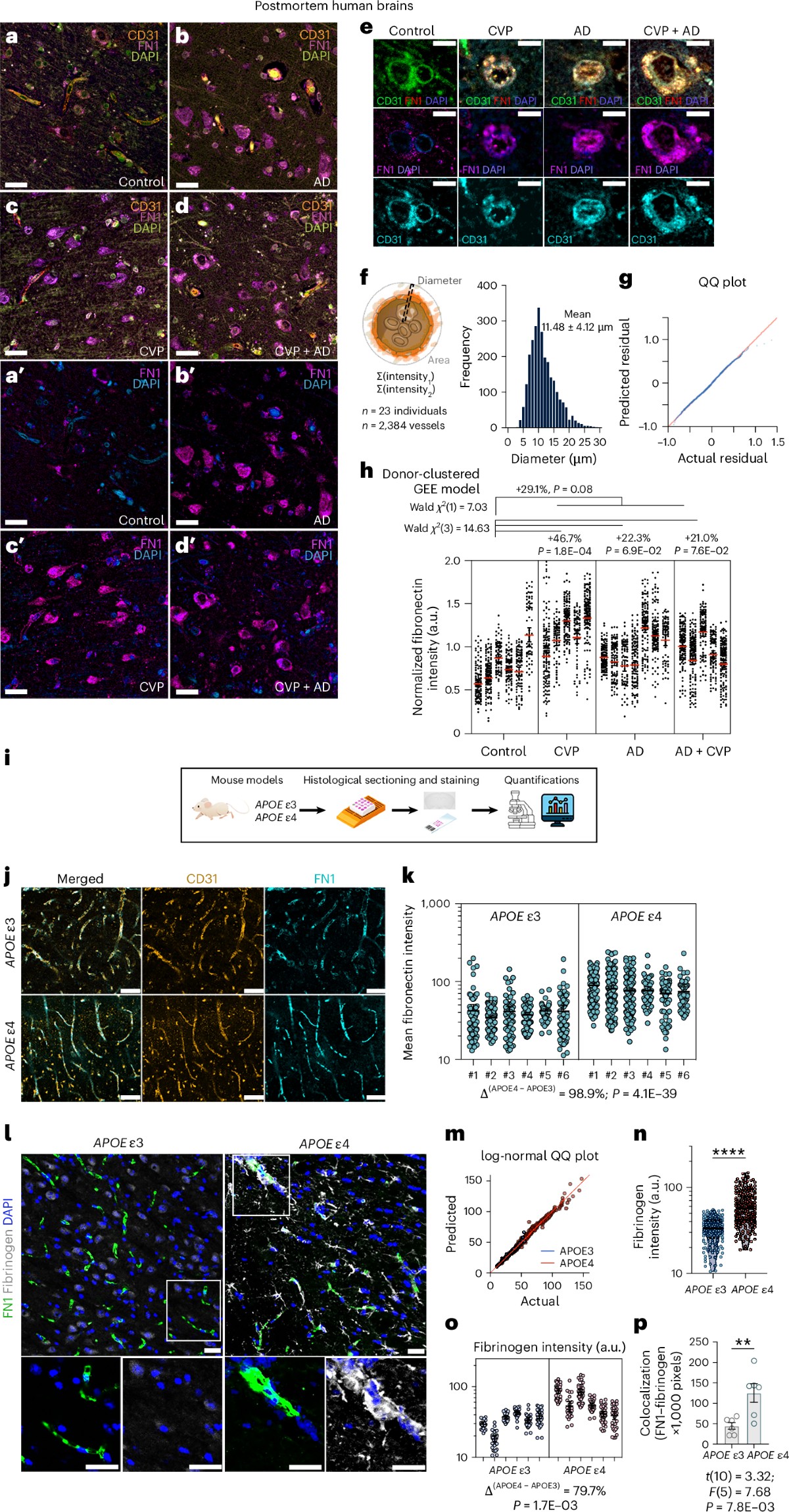 La brecha en la aduana cerebral: cómo el gen APOE4 y la fibronectina abren la puerta al Alzheimer décadas antes de los síntomas